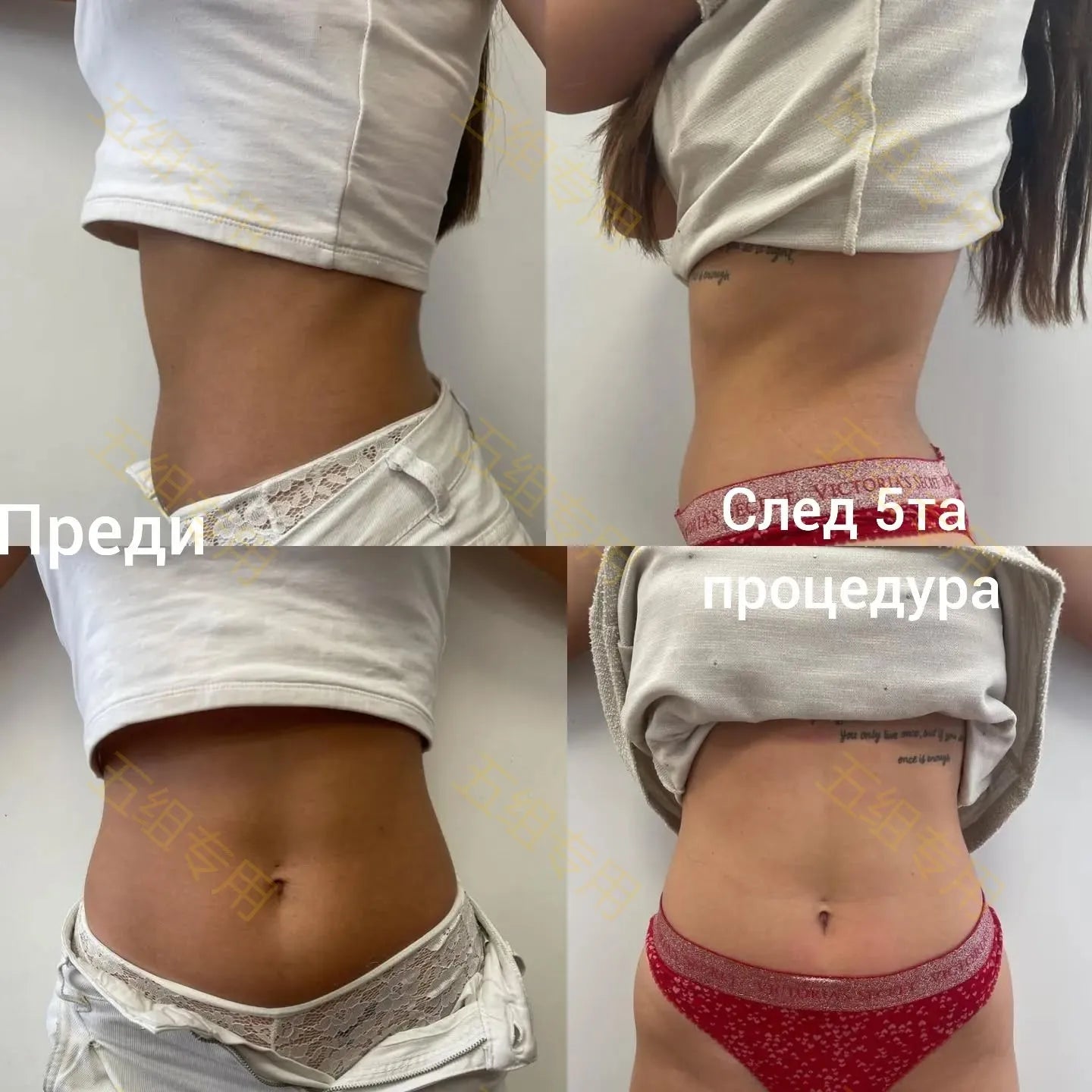 RF Electric Muscle Fat Removal Machine - Professional Body Sculpting & Slimming Tool